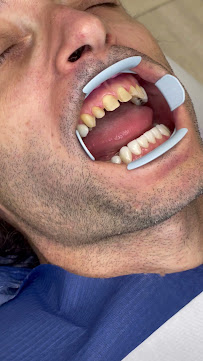 Marco Dental Tourism - Dentist Belgrade Serbia
