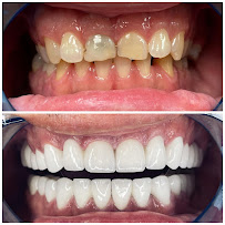 Marco Dental Tourism - Dentist Belgrade Serbia