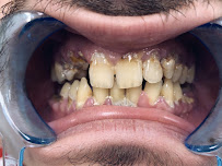 Marco Dental Tourism - Dentist Belgrade Serbia
