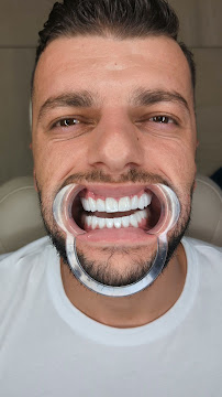 Marco Dental Tourism - Dentist Belgrade Serbia