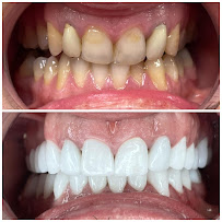 Marco Dental Tourism - Dentist Belgrade Serbia