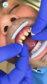 Marco Dental Tourism - Dentist Belgrade Serbia