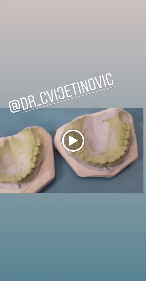 Stomatološka ordinacija Dr Cvijetinović Beograd - dental clinic in Belgrade, Serbia