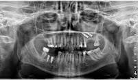 Stomatološka ordinacija Lavin Dental Clinic: Dr Lazar Jovanović