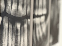 Advance Dental Clinic