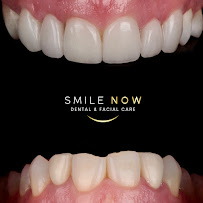 Smile Now Dental & Facial Care
