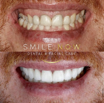 Smile Now Dental & Facial Care