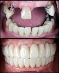 Novadent Dental Centre