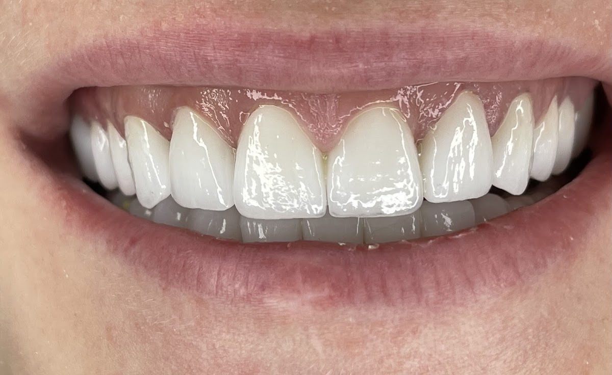 Dental Cross - dental clinic in Belgrade, Serbia