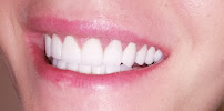 Dental Cross