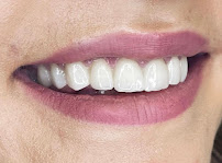 Dental Cross