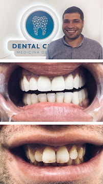 Dental Cross