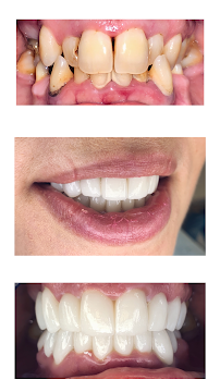 Dental Cross