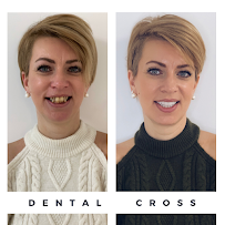 Dental Cross