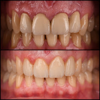 Dental clinic TIA dentico