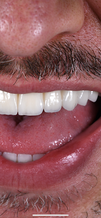 Dental clinic TIA dentico