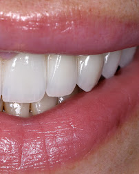 Dental clinic TIA dentico