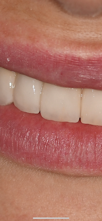 Dental clinic TIA dentico