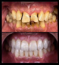 Dental clinic TIA dentico