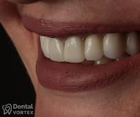 Dental Vortex - Stomatološka Ordinacija