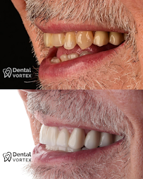 Dental Vortex - Stomatološka Ordinacija