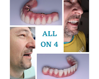 Dental Vortex - Stomatološka Ordinacija