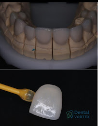 Dental Vortex - Stomatološka Ordinacija