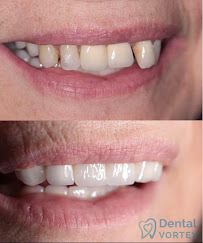 Dental Vortex - Stomatološka Ordinacija