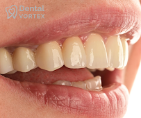 Dental Vortex - Stomatološka Ordinacija