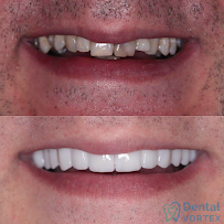 Dental Vortex - Stomatološka Ordinacija