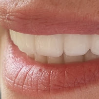 Stomatoloska ordinacija Dr. Branislava Smiljković Beograd