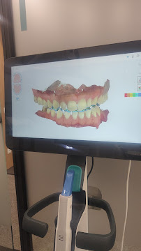 Dental Spa Clinics | English speaking dentist