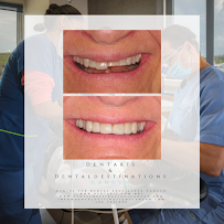 Dentist Cancun - Dental Destinations Cancun - Dental Tourism Mexico