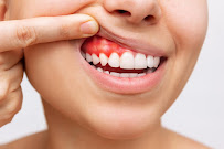 Clinica Corona Dental / Стоматология в Барселоне