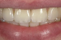 Clinica Corona Dental / Стоматология в Барселоне
