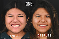 Dentistas de urgencias 24 horas Arte Sano Clínica Dental
