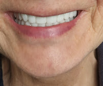 Alvarado Dental Clinic