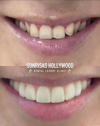 SONRISAS HOLLYWOOD VALENCIA