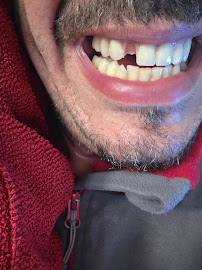 Vericat Implantología Dental Inmediata València