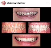 Clínica Dental Gallego