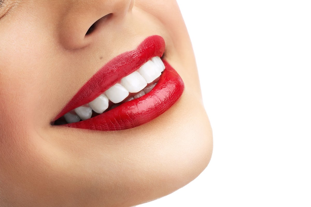 Clinica Dental Incilex Valencia - Dentistas y Especialistas en Implantologia y Ortodoncia, Dientes fijos en 1 dia - dental clinic in Valencia, Spain