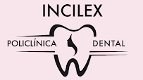 Clinica Dental Incilex Valencia - Dentistas y Especialistas en Implantologia y Ortodoncia, Dientes fijos en 1 dia
