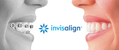 Clinica Dental Incilex Valencia - Dentistas y Especialistas en Implantologia y Ortodoncia, Dientes fijos en 1 dia