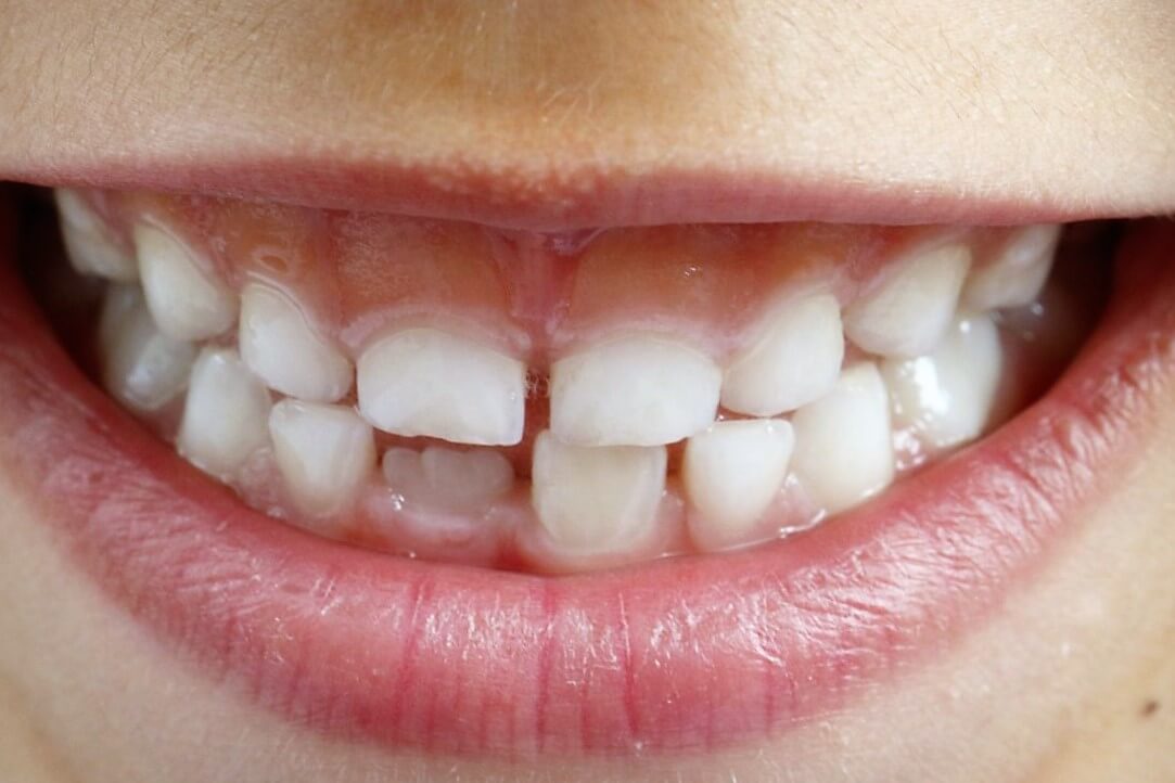 Clínica Dental Monlleó - Valencia - dental clinic in Valencia, Spain