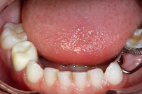 Clínica Dental Monlleó - Valencia