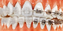 Clínica Dental Monlleó - Valencia
