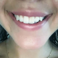 Clínica Dental Monlleó - Valencia