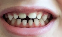 Clínica Dental Monlleó - Valencia