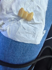 Clinica Dental Crooke Marbella