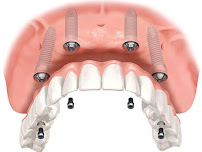 Clinica Dental Crooke Marbella